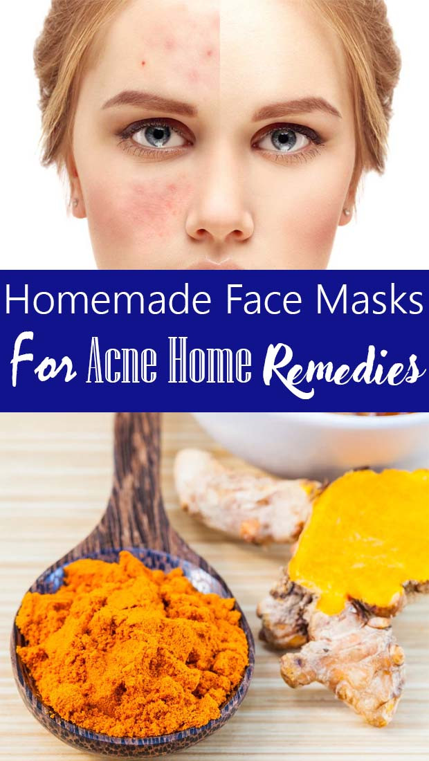 Acne Facial Mask DIY
 Great Homemade Face Mask For Acne Overnight