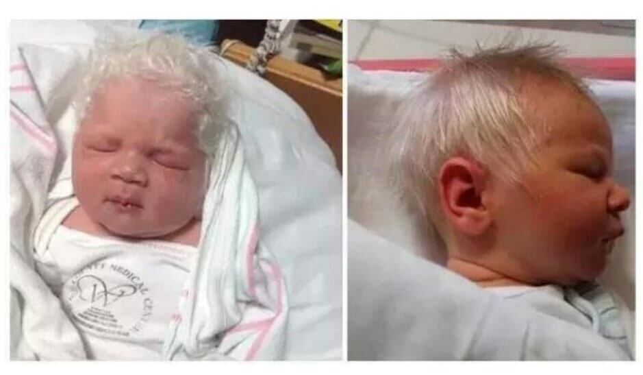 Baby Born With Gray Hair
 Baby Born With White Hair Is e The Rarest And Most