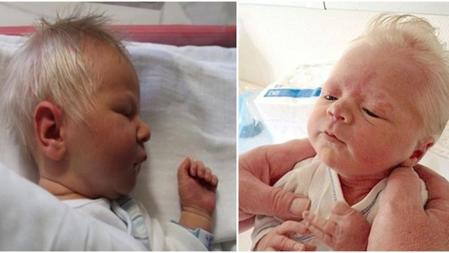 Baby Born With Gray Hair
 Parents Confused Why Their Baby Is Born With Silver Hair