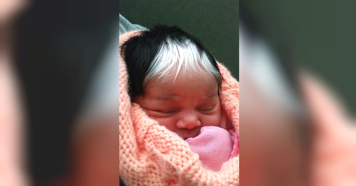 Baby Born With Gray Hair
 Baby Girl Is Born With Incredible Streak White Hair