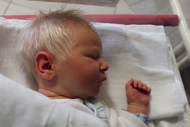 Baby Born With Gray Hair
 Gray haired baby born in Szekesfehervar – Daily News Hungary