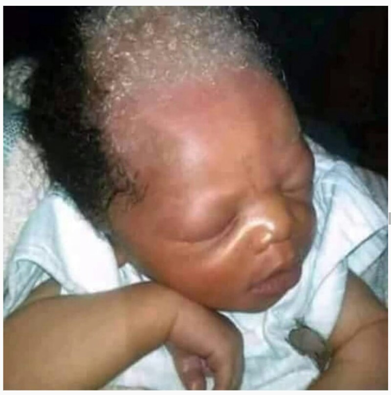 Baby Born With Gray Hair
 New Born Baby With Grey Hair Celebrities Nigeria