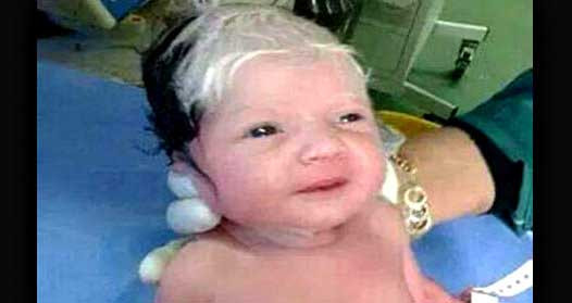 Baby Born With Gray Hair
 Syrian baby born with grey hair in Lebanon
