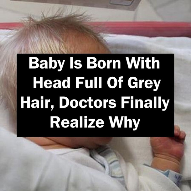 Baby Born With Gray Hair
 Baby Is Born With Head Full Gray Hair Doctors Finally