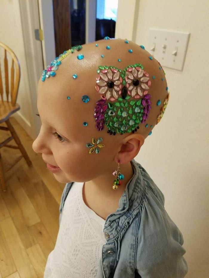 Crazy Hairstyles For Girl
 This 7 Year Old Girl Didn’t Let Alopecia Stop Her From