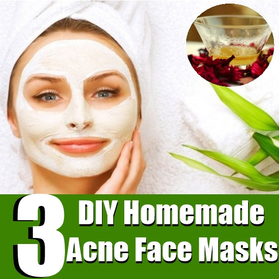 DIY Face Mask For Pimples
 Top 3 DIY Homemade Acne Face Masks