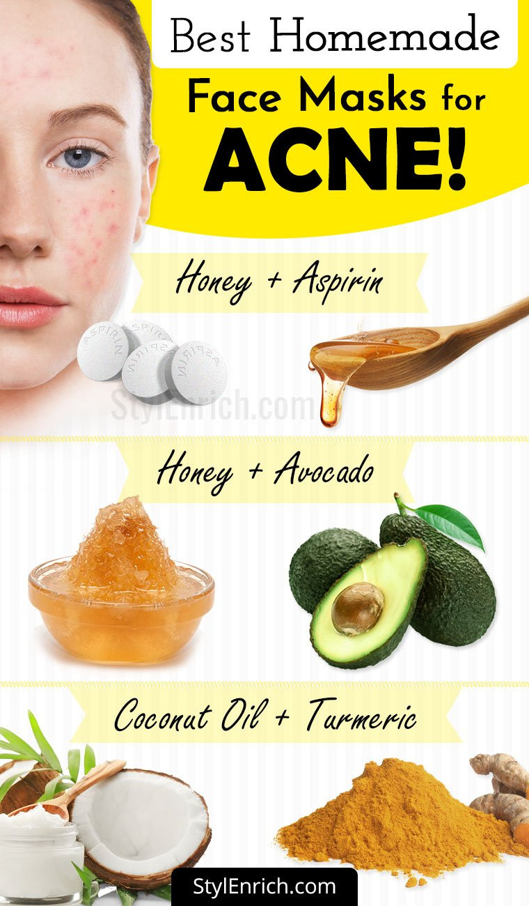 DIY Face Mask To Get Rid Of Acne
 Homemade Face Mask For Acne Treatment At Home