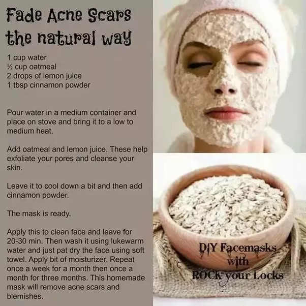 DIY Face Mask To Get Rid Of Acne
 What are the best DIY face masks for acne scars Quora
