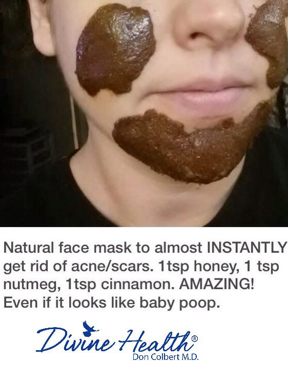 DIY Face Mask To Get Rid Of Acne
 17 Best images about Beauty Secrets Acne on Pinterest