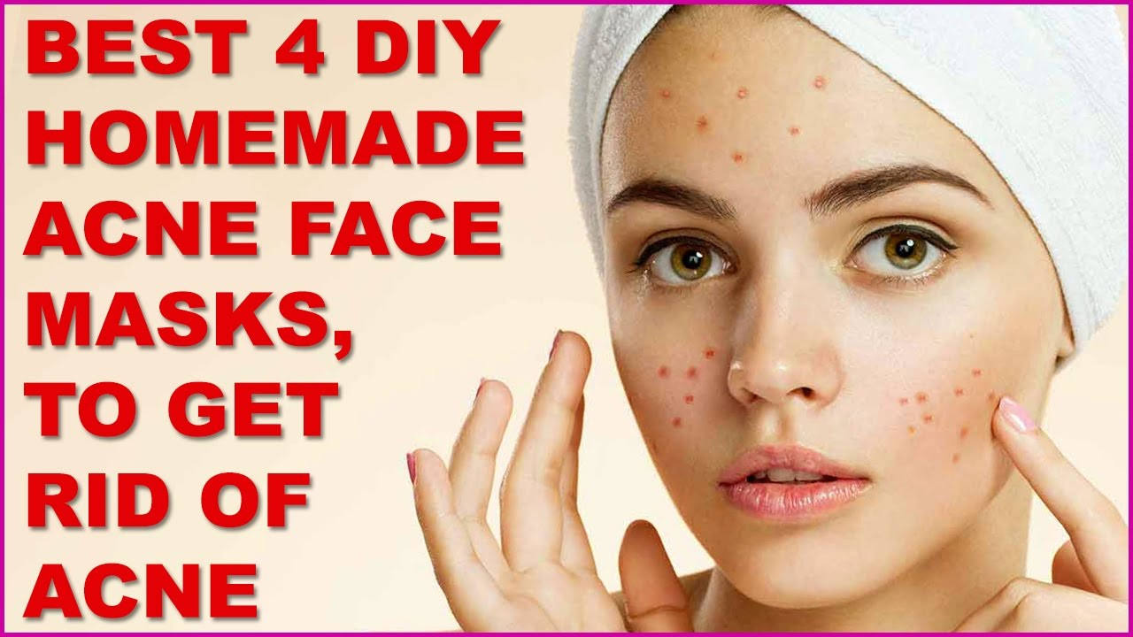 DIY Face Mask To Get Rid Of Acne
 Best 4 DIY Homemade Acne Face Masks To Get Rid Acne
