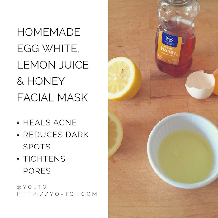 DIY Facemask For Pimples
 Egg White Lemon Juice & Honey Facial Mask for Acne Scars