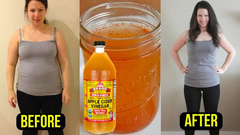 Weight Loss With Apple Cider Vinegar
 How To Use Apple Cider Vinegar For Weight Loss In A Week